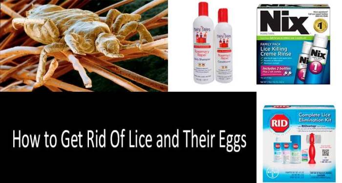 Lice natural remedies rid get