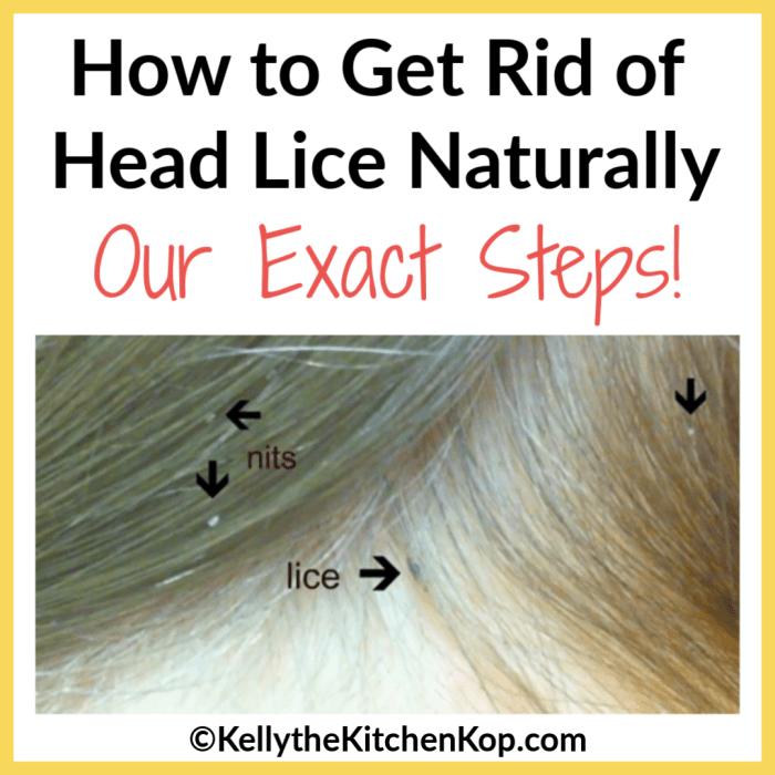 The effectiveness of natural repellents for lice