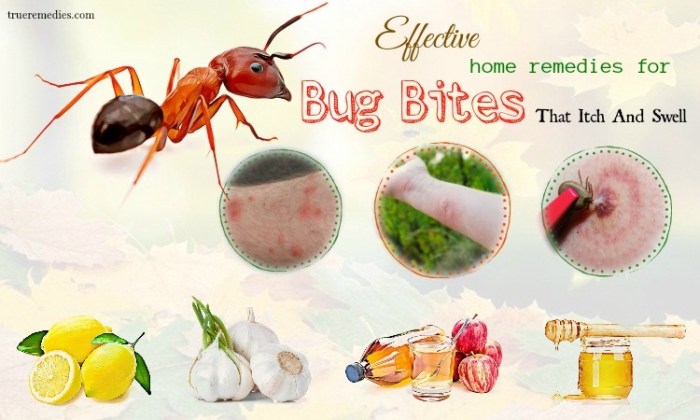 Traditional remedies for bug bites and stings